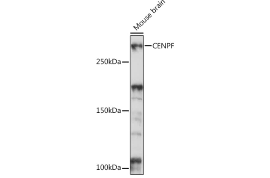 Western Blot - Anti-CENPF Antibody (A308098) - Antibodies.com