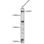 Western Blot - Anti-CENPF Antibody (A308098) - Antibodies.com