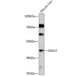 Western Blot - Anti-GALK2 Antibody (A308099) - Antibodies.com
