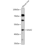 Western Blot - Anti-GALK2 Antibody (A308099) - Antibodies.com