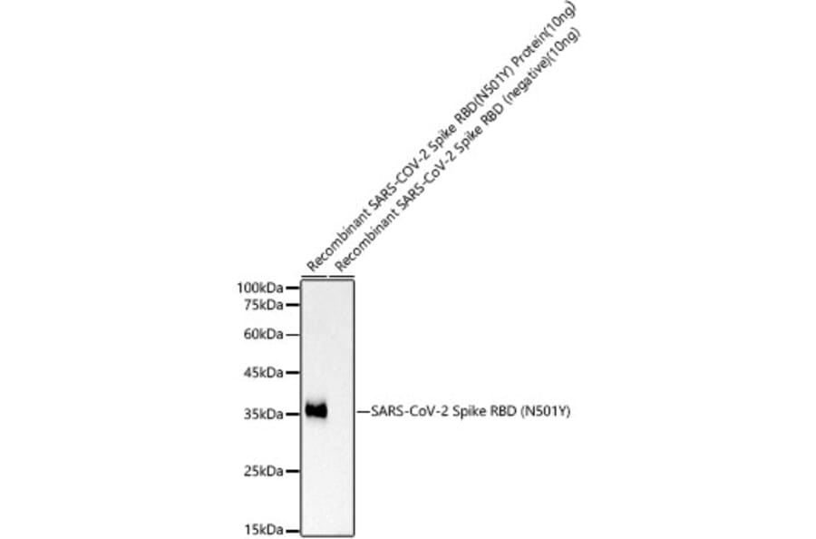 Western Blot - Anti-SARS-CoV2 Spike Glycoprotein RBD (N501Y) Antibody [ARC52673] (A308100) - Antibodies.com