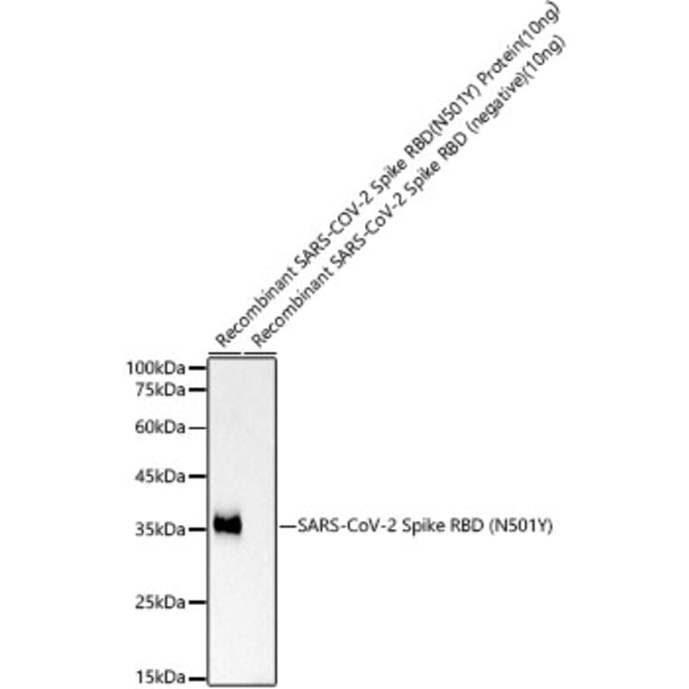 Western Blot - Anti-SARS-CoV2 Spike Glycoprotein RBD (N501Y) Antibody [ARC52673] (A308100) - Antibodies.com