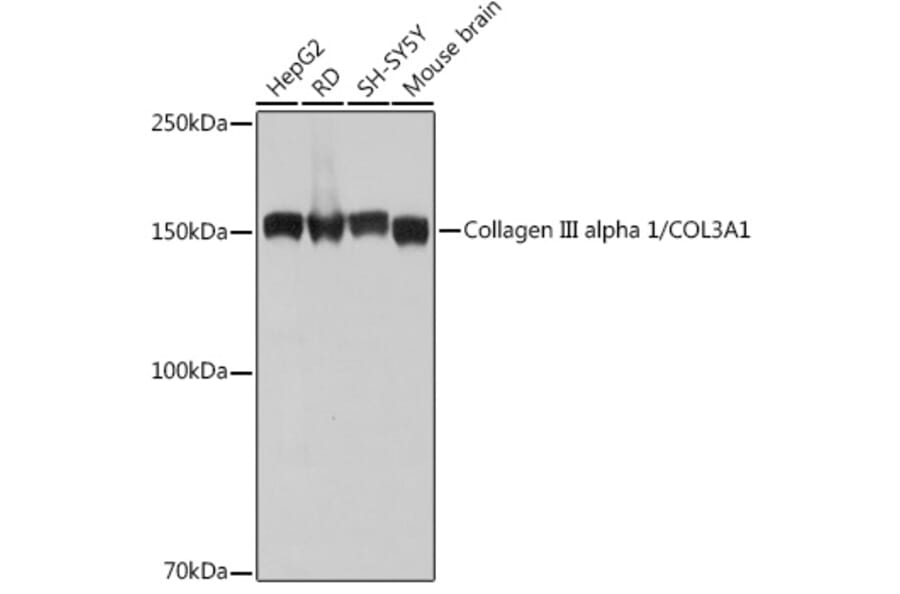 Western Blot - Anti-Collagen III Antibody [ARC2542] (A308101) - Antibodies.com