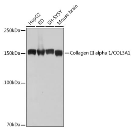 Western Blot - Anti-Collagen III Antibody [ARC2542] (A308101) - Antibodies.com