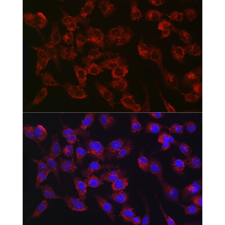 Immunofluorescence - Anti-Collagen III Antibody [ARC2542] (A308101) - Antibodies.com