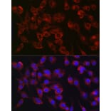 Immunofluorescence - Anti-Collagen III Antibody [ARC2542] (A308101) - Antibodies.com