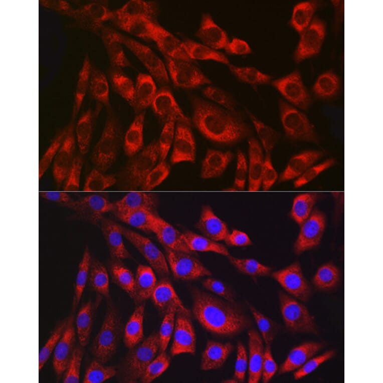 Immunofluorescence - Anti-Collagen III Antibody [ARC2542] (A308101) - Antibodies.com