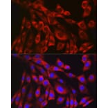 Immunofluorescence - Anti-Collagen III Antibody [ARC2542] (A308101) - Antibodies.com