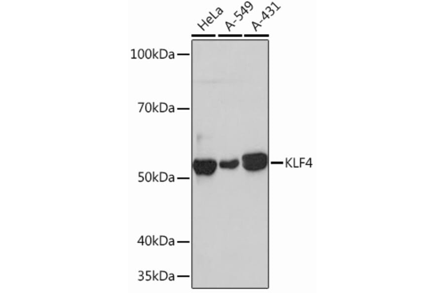Western Blot - Anti-KLF4 Antibody [ARC0721] (A308102) - Antibodies.com