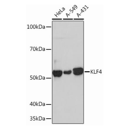 Western Blot - Anti-KLF4 Antibody [ARC0721] (A308102) - Antibodies.com