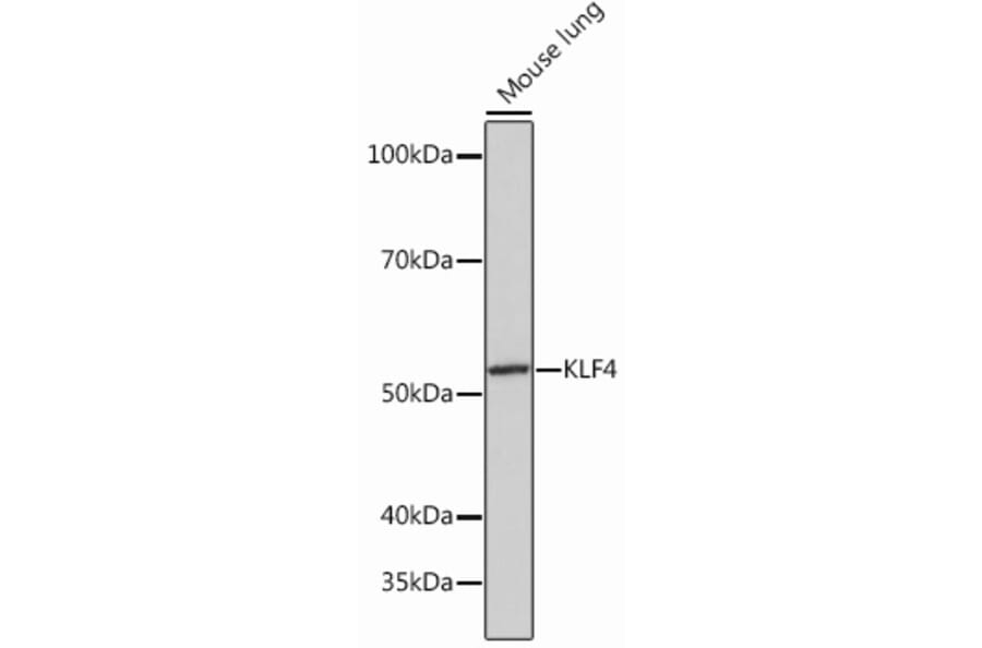 Western Blot - Anti-KLF4 Antibody [ARC0721] (A308102) - Antibodies.com