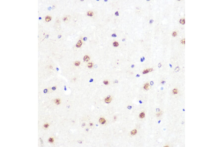 Immunohistochemistry - Anti-KLF4 Antibody [ARC0721] (A308102) - Antibodies.com
