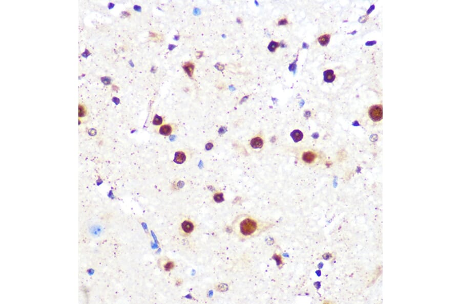 Immunohistochemistry - Anti-KLF4 Antibody [ARC0721] (A308102) - Antibodies.com