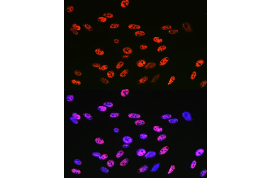 Immunofluorescence - Anti-KLF4 Antibody [ARC0721] (A308102) - Antibodies.com