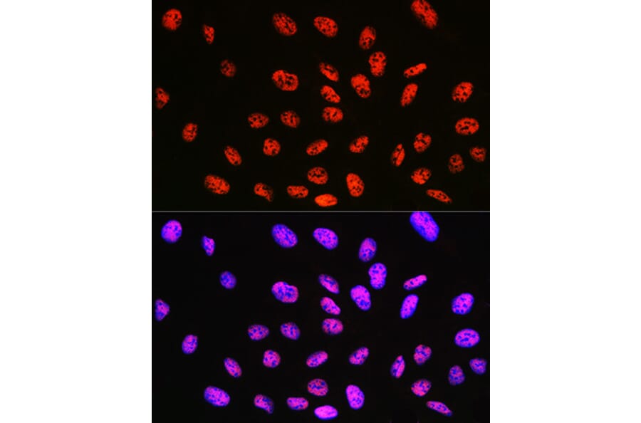 Immunofluorescence - Anti-KLF4 Antibody [ARC0721] (A308102) - Antibodies.com