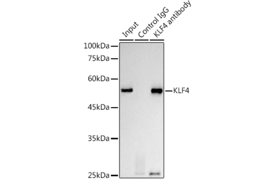 Western Blot - Anti-KLF4 Antibody [ARC0721] (A308102) - Antibodies.com
