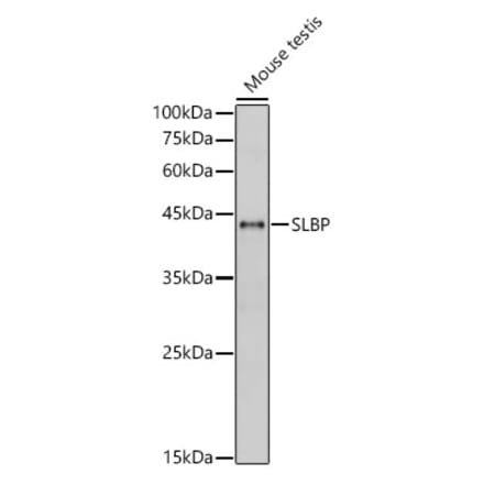 Western Blot - Anti-SLBP Antibody (A308103) - Antibodies.com