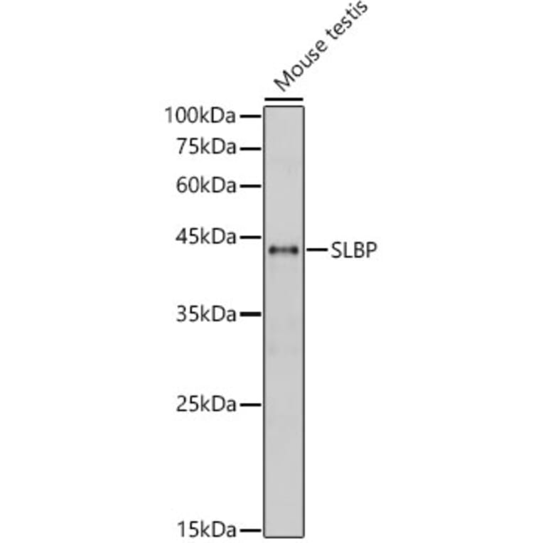 Western Blot - Anti-SLBP Antibody (A308103) - Antibodies.com