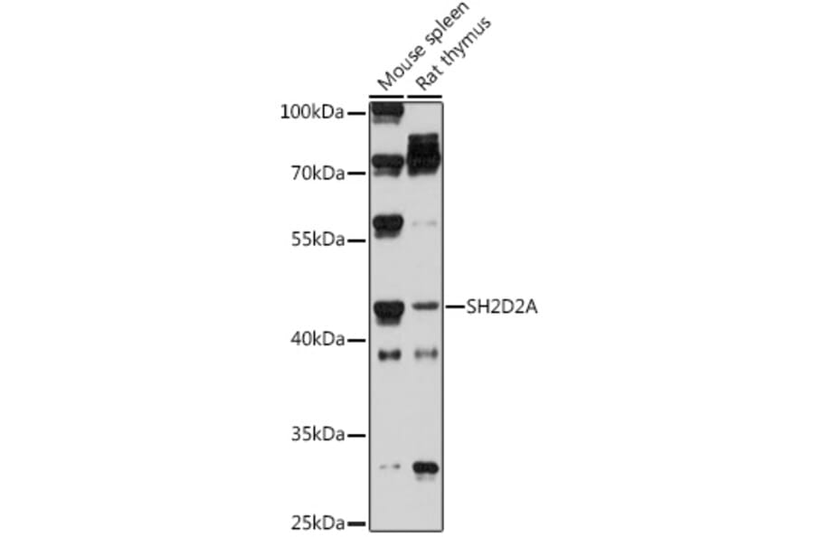 Western Blot - Anti-SH2D2A/SCAP Antibody (A308104) - Antibodies.com