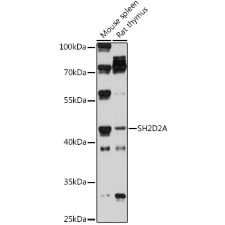 Western Blot - Anti-SH2D2A/SCAP Antibody (A308104) - Antibodies.com