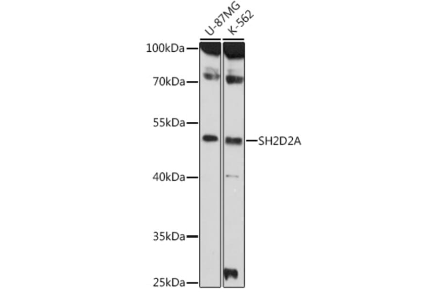 Western Blot - Anti-SH2D2A/SCAP Antibody (A308104) - Antibodies.com
