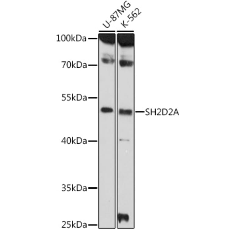 Western Blot - Anti-SH2D2A/SCAP Antibody (A308104) - Antibodies.com