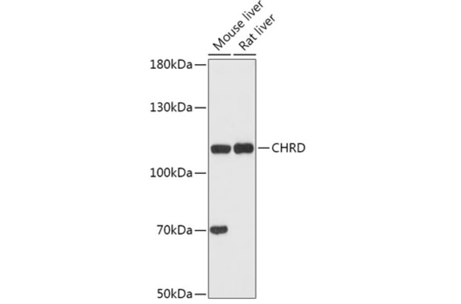 Western Blot - Anti-Chordin Antibody (A308105) - Antibodies.com
