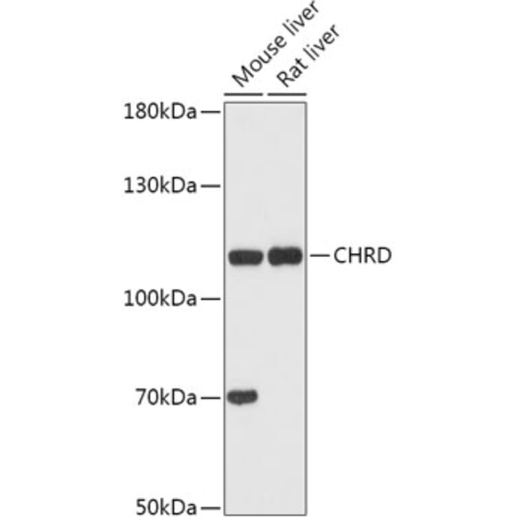 Western Blot - Anti-Chordin Antibody (A308105) - Antibodies.com