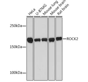 Western Blot - Anti-ROCK2 Antibody [ARC0744] (A308106) - Antibodies.com