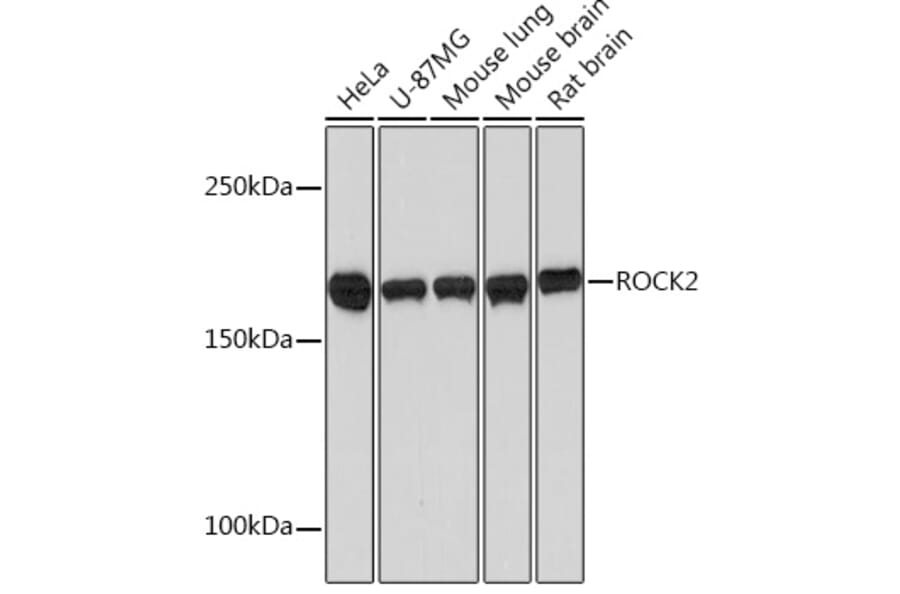 Western Blot - Anti-ROCK2 Antibody [ARC0744] (A308106) - Antibodies.com