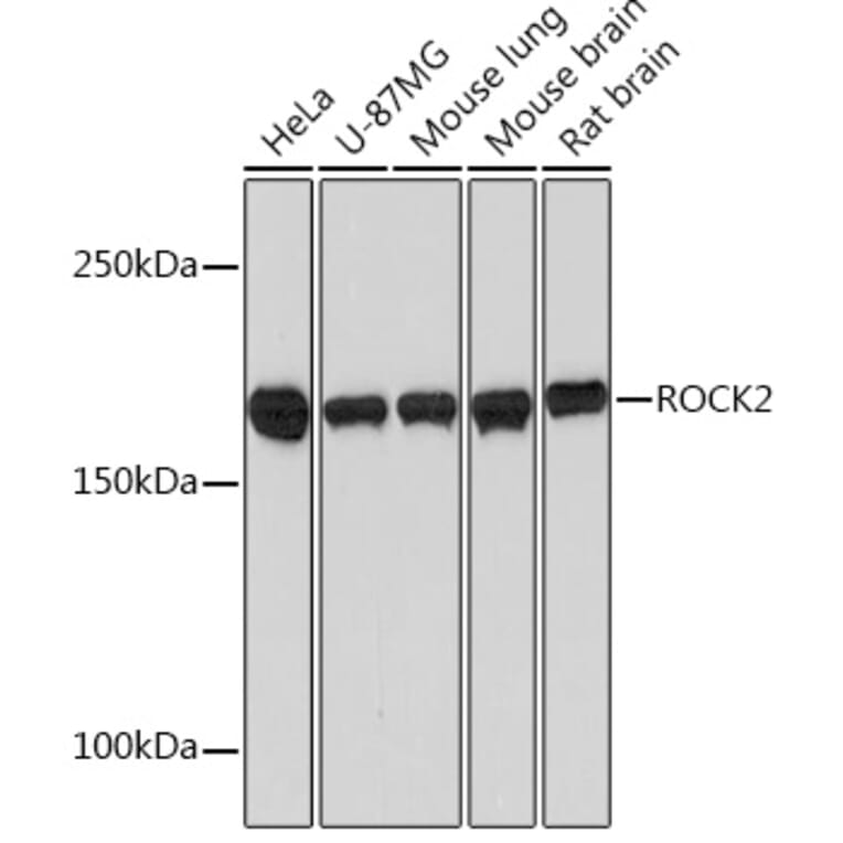 Western Blot - Anti-ROCK2 Antibody [ARC0744] (A308106) - Antibodies.com