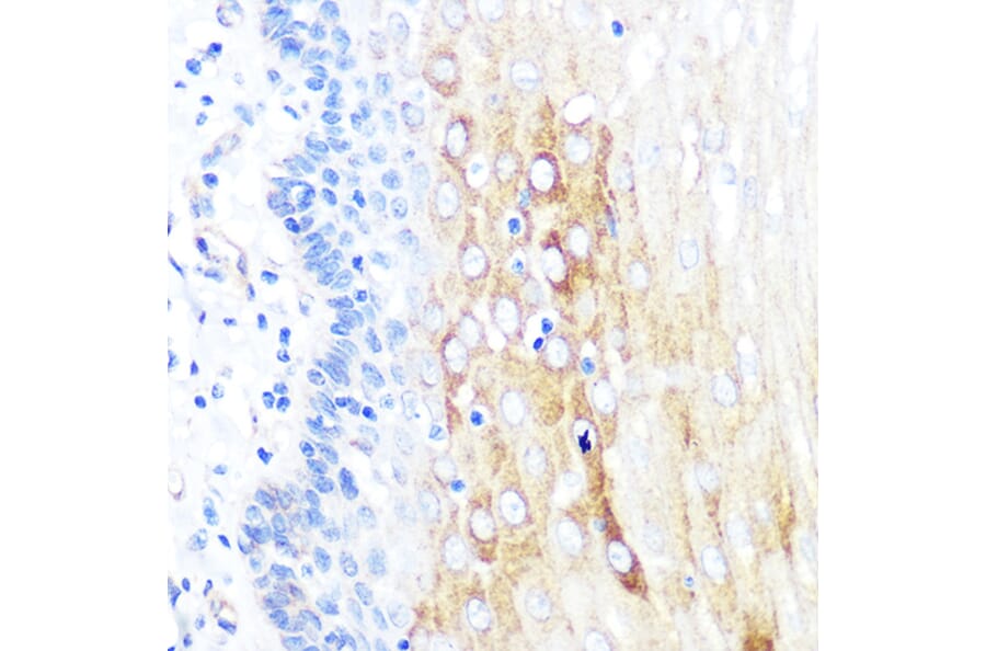 Immunohistochemistry - Anti-ROCK2 Antibody [ARC0744] (A308106) - Antibodies.com