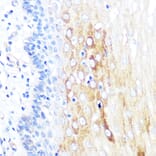 Immunohistochemistry - Anti-ROCK2 Antibody [ARC0744] (A308106) - Antibodies.com