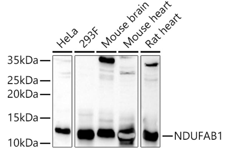 Western Blot - Anti-NDUFAB1 Antibody (A308107) - Antibodies.com