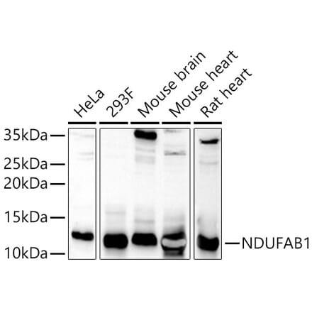 Western Blot - Anti-NDUFAB1 Antibody (A308107) - Antibodies.com