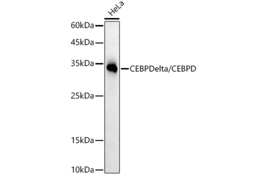 Western Blot - Anti-CEBP Delta/CEBPD Antibody [ARC52980] (A308108) - Antibodies.com