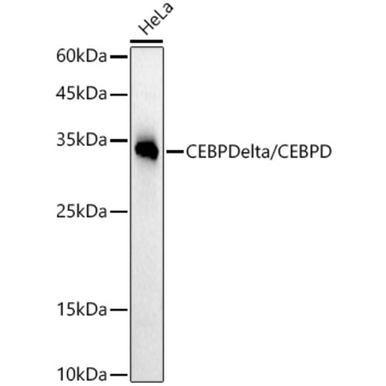 Western Blot - Anti-CEBP Delta/CEBPD Antibody [ARC52980] (A308108) - Antibodies.com