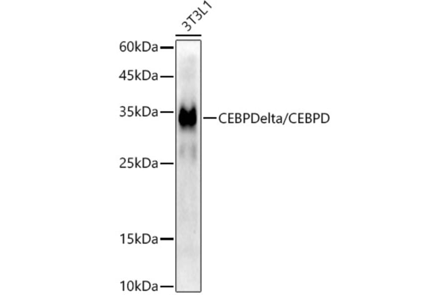 Western Blot - Anti-CEBP Delta/CEBPD Antibody [ARC52980] (A308108) - Antibodies.com
