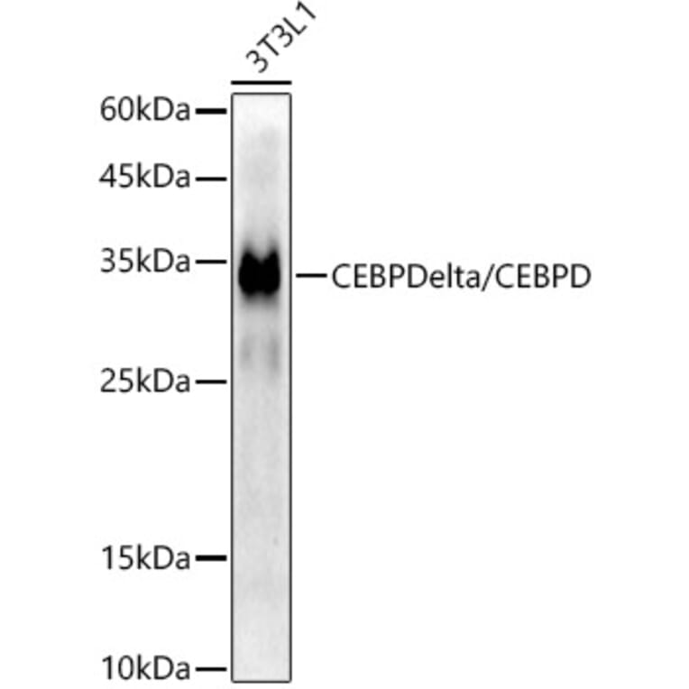 Western Blot - Anti-CEBP Delta/CEBPD Antibody [ARC52980] (A308108) - Antibodies.com