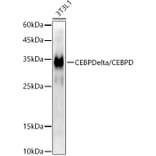 Western Blot - Anti-CEBP Delta/CEBPD Antibody [ARC52980] (A308108) - Antibodies.com