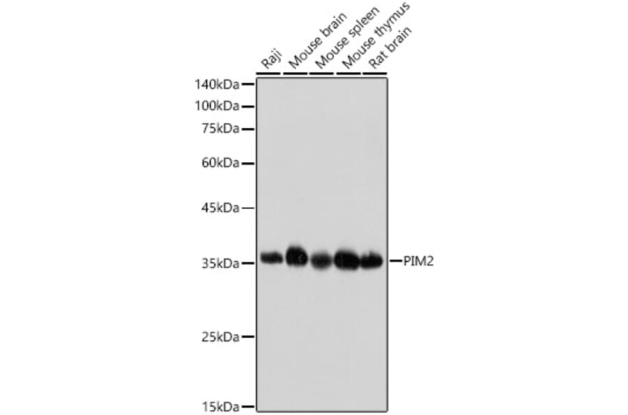 Western Blot - Anti-PIM2 Antibody [ARC2497] (A308109) - Antibodies.com