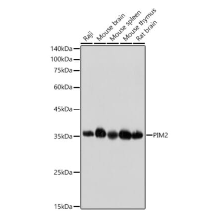 Western Blot - Anti-PIM2 Antibody [ARC2497] (A308109) - Antibodies.com