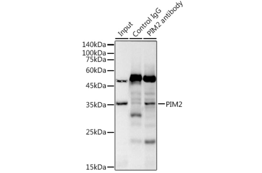 Western Blot - Anti-PIM2 Antibody [ARC2497] (A308109) - Antibodies.com