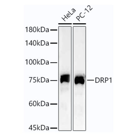 Western Blot - Anti-DRP1 Antibody [ARC54410] (A308111) - Antibodies.com