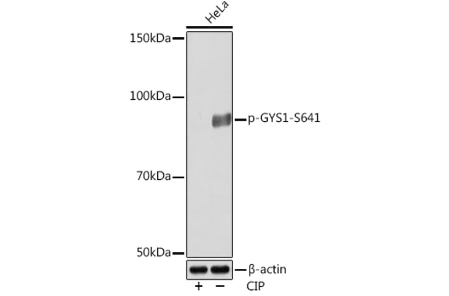 Western Blot - Anti-Glycogen synthase 1/GYS1 (phospho Ser641) Antibody [ARC0207] (A308112) - Antibodies.com