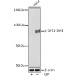 Western Blot - Anti-Glycogen synthase 1/GYS1 (phospho Ser641) Antibody [ARC0207] (A308112) - Antibodies.com