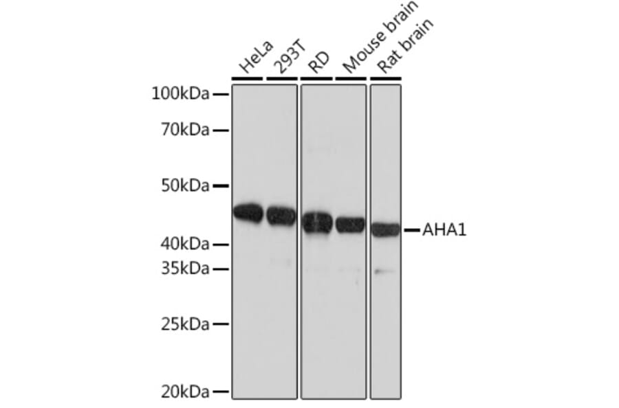 Western Blot - Anti-AHA1 Antibody [ARC1623] (A308114) - Antibodies.com