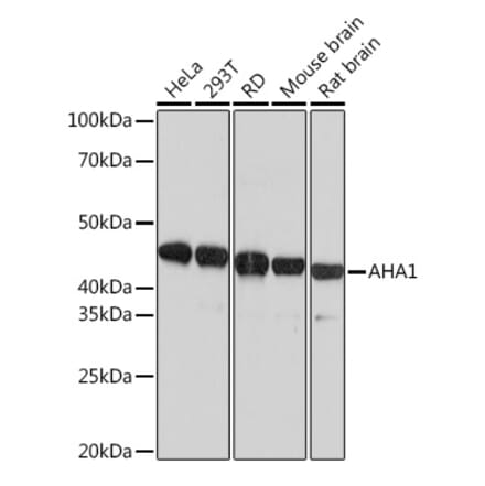 Western Blot - Anti-AHA1 Antibody [ARC1623] (A308114) - Antibodies.com