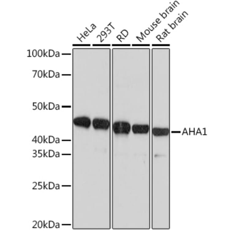 Western Blot - Anti-AHA1 Antibody [ARC1623] (A308114) - Antibodies.com