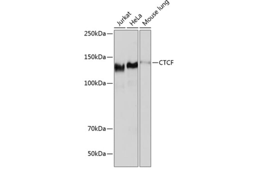 Western Blot - Anti-CTCF Antibody [ARC0067] (A308115) - Antibodies.com